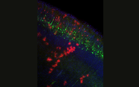 The sensational high-resolution photo of mouse brain cells.