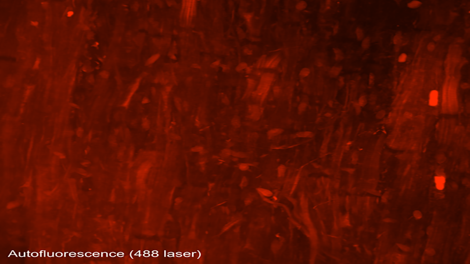 An autofluorescence image of cells that make up the heart/cardiac muscle, from Dr. Seth Currlin of University of Florida