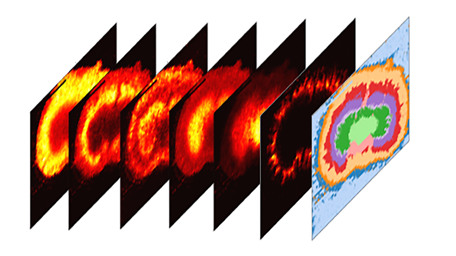 Maps of imaging mass spectrometry data from rat brain, courtesy of Hang Hu at PNNL