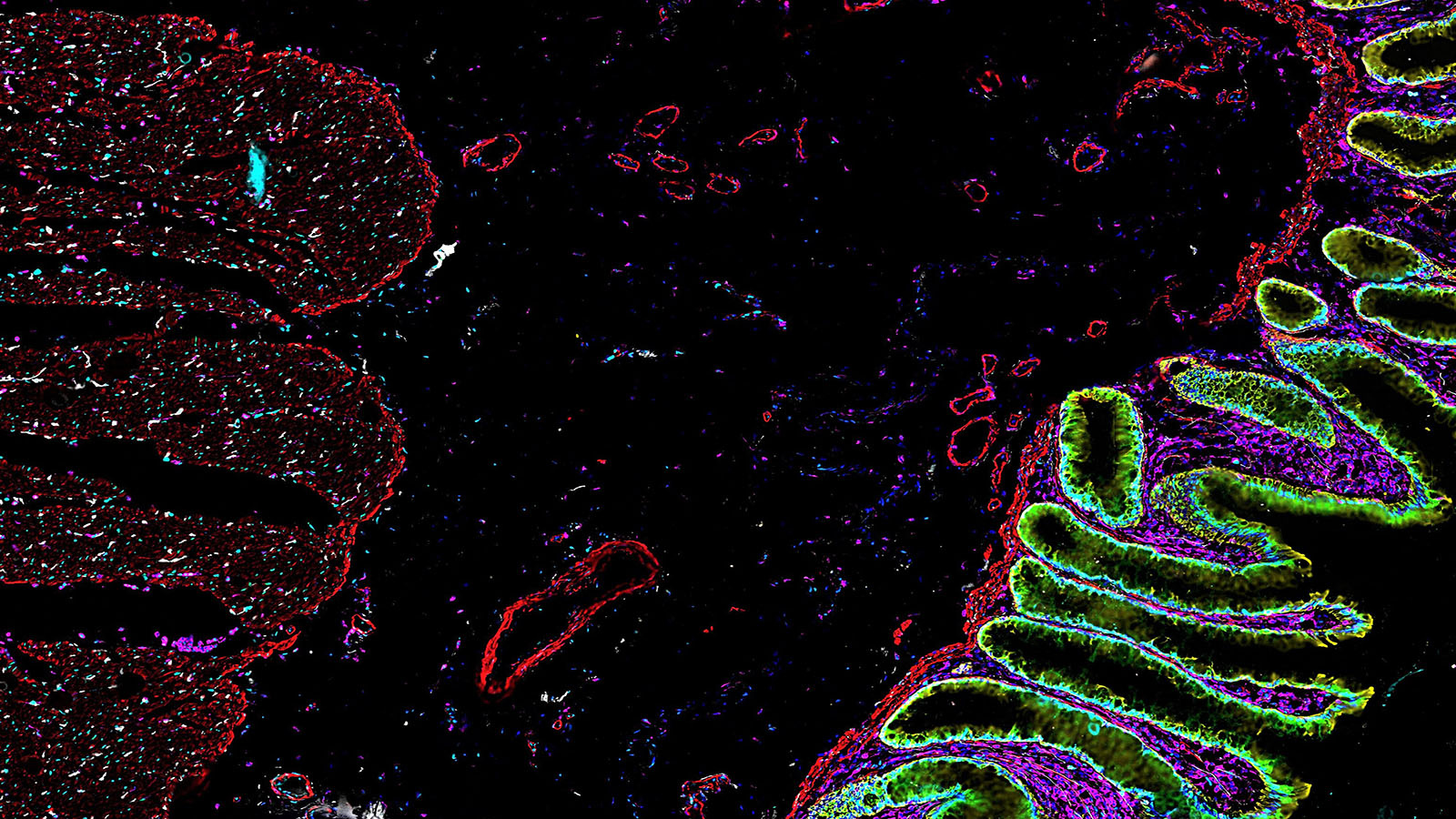 CODEX of healthy colon, courtesy of John Hickey at Stanford