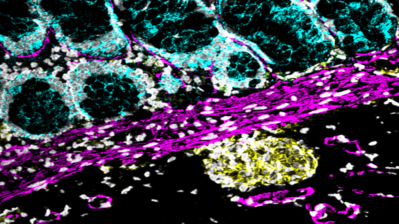 Human colon cells made by the researchers at Stanford University's Bendall lab that uses single-cell metabolic regulome profiling (scMEP).