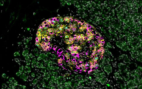 CyCIF image of a pancreatic islet from Sam Ewing at University of Florida
