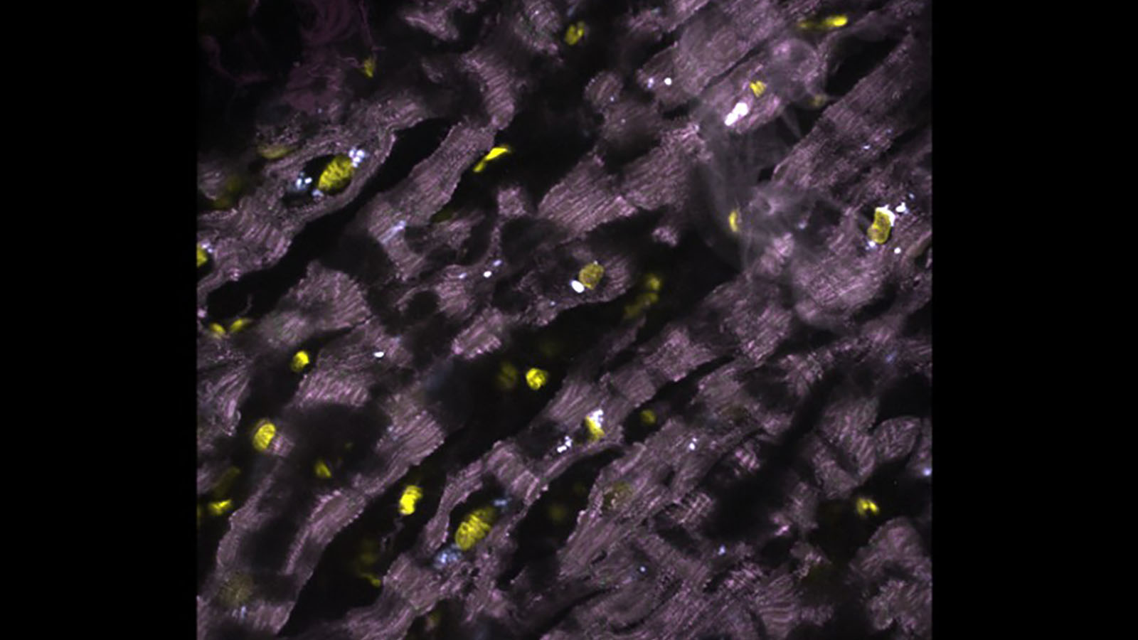 seqFISH image of healthy human heart, courtesy of Long Cai's lab at CalTech