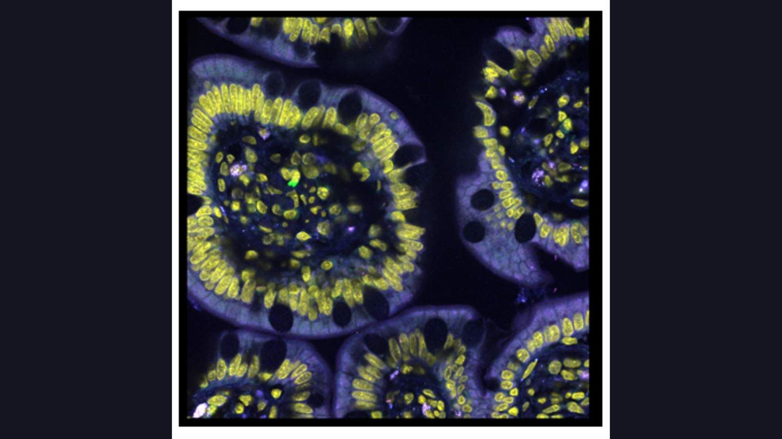 RNA transcripts in sections of the small intestine, courtesy of Dr. Long Cai at Cal Tech