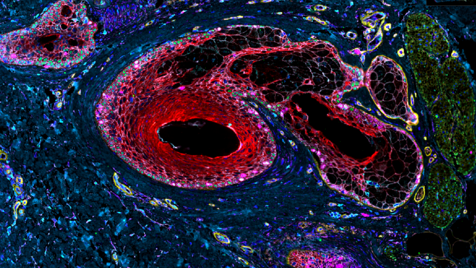 Image shows 9 markers of a follicle in skin, courtesy of Dr. Fiona Ginty at GE Research
