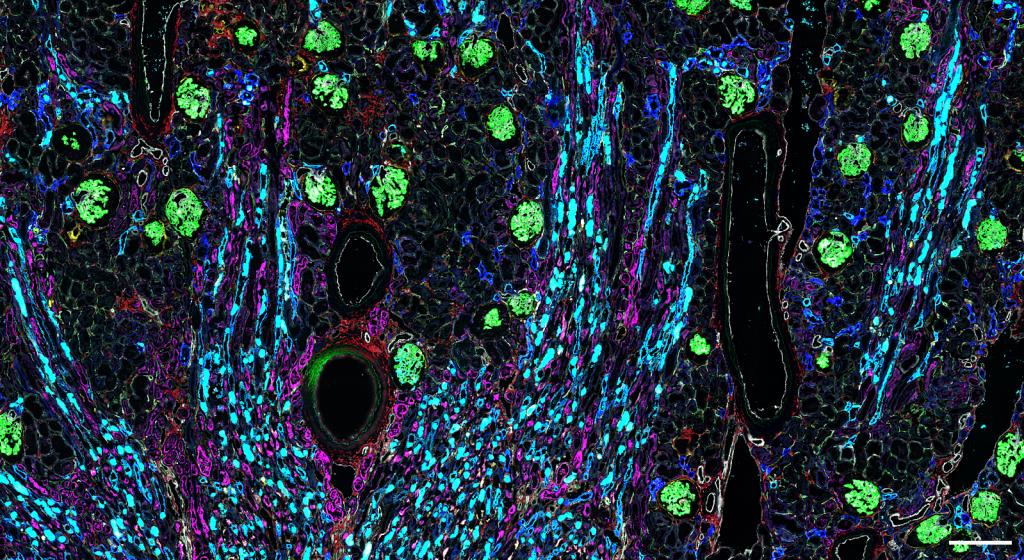 Multicolored image of fluorescent markers showing the location of different cell types throughout the kidney