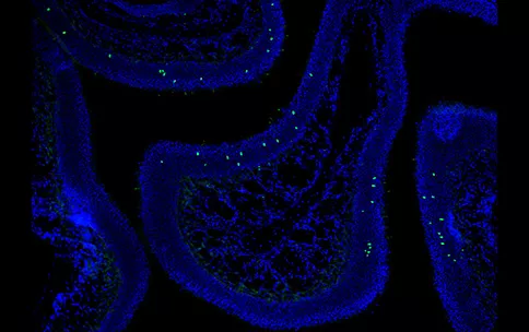 Image: Genetic Engineering & Biotechnology News.