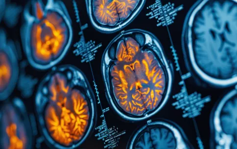 High-resolution PET/CT scan images displaying detailed brain activity with highlighted regions