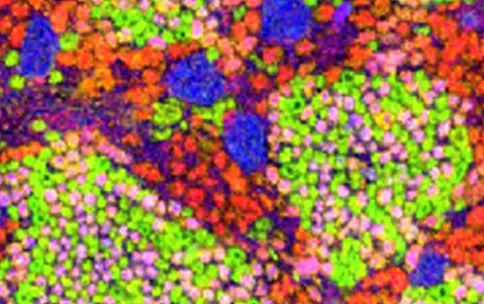 MALDI and microscopic image of the distribution of lipids throughout the kidney
