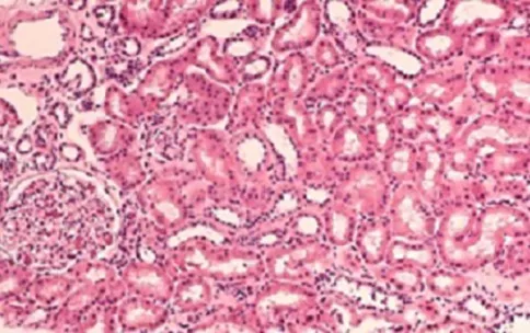 Kidney histology.