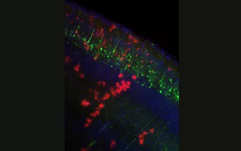 The sensational high-resolution photo of mouse brain cells.